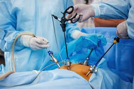 Endoscopic Procedures